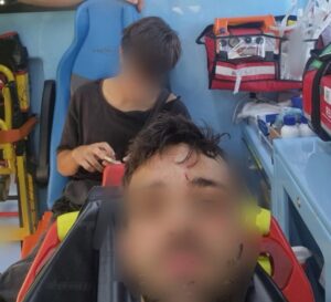 Immagine sfocata dei due militanti dei collettivi studenteschi OSA in ambulanza, dopo la violenza di matrice sionista che hanno subito.